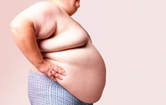 obesity time bomb costs GDP huge